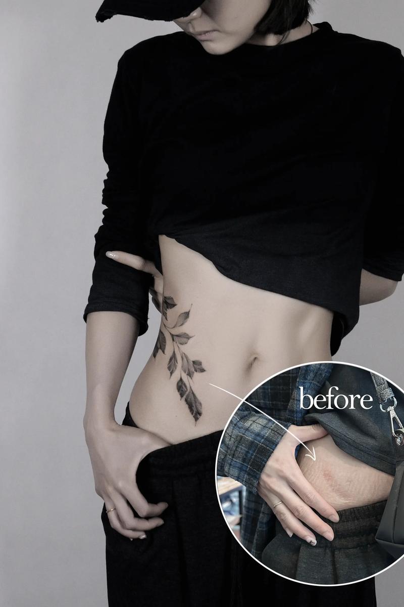 疤痕创意纹身-图1