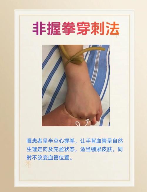 抽血不痛的技巧-图3