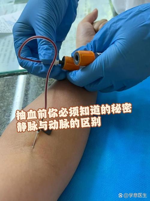 抽血不痛的技巧，抽血不痛的技巧有哪些-图1