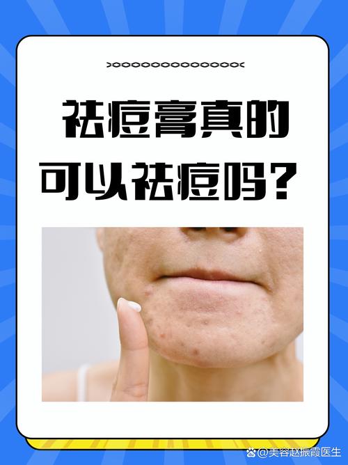 祛痘创意广告-图3