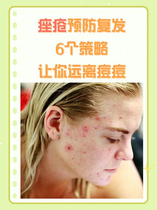 祛痘创意广告-图1